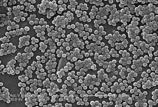 Nas bactérias, o material genético fica localizado numa região denominada nucleoide. Em alguns casos, moléculas menores de DNA contém genes que exercem funções diversas, como resistência a antibióticos e ação tóxica injetada em bactérias competidoras.