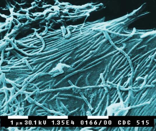 O vírus do Ebola mudou muito pouco desde a década de 1970. Ainda assim, o risco de que uma mutação permita que o microorganismo se transporte pelo ar é real e preocupa os cientistas. Em 1989, cinco macacos transportados da Indonésia para os Estados Unidos morreram em um laboratório, com suspeita de Ebola. Descobriu-se, mais tarde, que o tipo de vírus encontrado nos macacos poderia ser transmissível por partículas de água presentes na atmosfera. Essa modalidade de vírus jamais infectou humanos. (Foto: Wikimedia Commons)