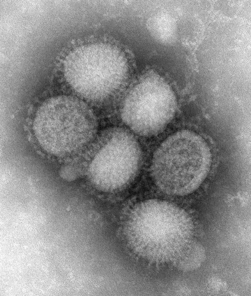 Os vírus são organismos formados por proteínas e ácidos nucleicos, principalmente. Acelulados, eles só têm condições de realizar suas atividades vitais quando estão no interior de outras células vivas. Por isso, são obrigatoriamente parasitas.