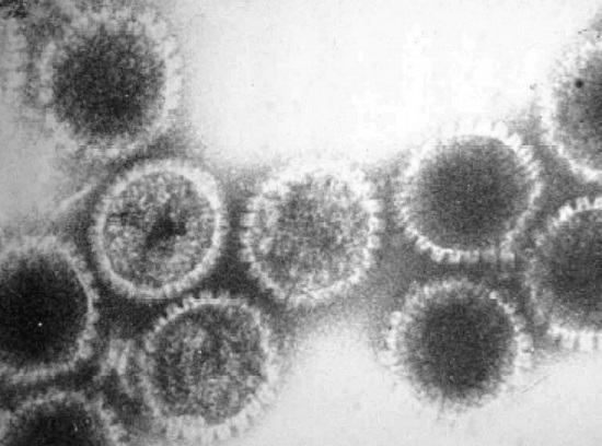 Para se reproduzir, um vírus infecta a célula hospedeira, ligando suas proteínas virais à proteína receptora do outro organismo. É assim que ocorre a multiplicação do material genético, usando para isso a energia do metabolismo do hospedeiro. Para se reproduzir, um vírus infecta a célula hospedeira, ligando suas proteínas virais à proteína receptora do outro organismo. É assim que ocorre a multiplicação do material genético, usando para isso a energia do metabolismo do hospedeiro.