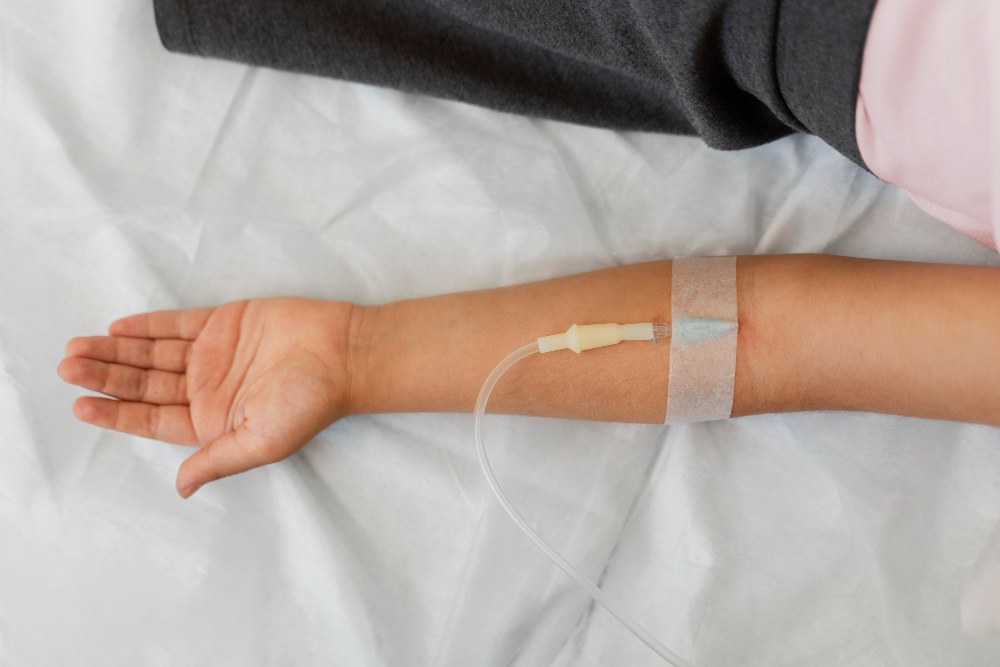cateter Cateter colocado na veia de paciente. O braço está apoiado na cama